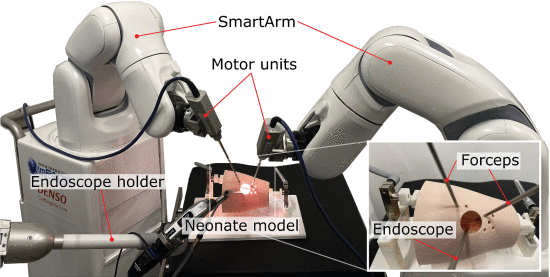 開発した手術ロボットで食道閉鎖症の模擬手術を行っているところ 開発した手術ロボットで食道閉鎖症の模擬手術を行っているところ